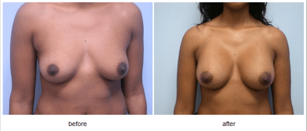 A recent breast surgeon job in the  area